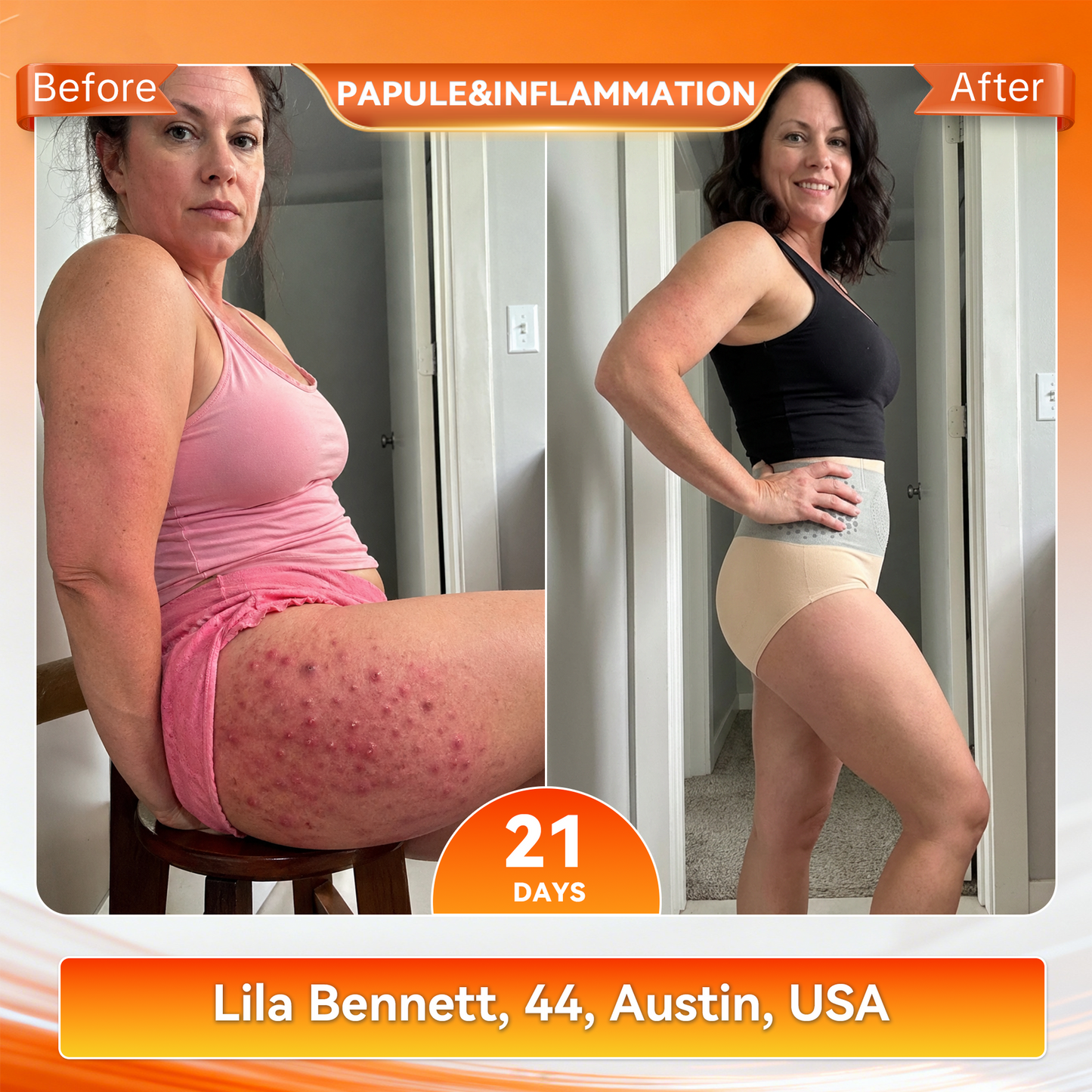 𝐎𝐟𝐟𝐢𝐜𝐢𝐚𝐥 𝐁𝐫𝐚𝐧𝐝 𝐒𝐭𝐨𝐫𝐞 👙 Natravor® 𝟐𝟎𝟐𝟔 𝐌𝐨𝐫𝐢𝐧𝐠𝐚 & 𝐁𝐞𝐫𝐛𝐞𝐫𝐢𝐧𝐞 𝟒-𝐈𝐧-𝟏 𝐌𝐢𝐜𝐫𝐨-𝐏𝐚𝐫𝐭𝐢𝐜𝐥𝐞 𝐒𝐜𝐮𝐥𝐩𝐭𝐢𝐧𝐠 & 𝐅𝐚𝐭-𝐁𝐮𝐫𝐧 𝐒𝐡𝐨𝐫𝐭𝐬