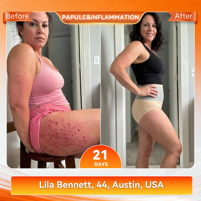 𝐎𝐟𝐟𝐢𝐜𝐢𝐚𝐥 𝐁𝐫𝐚𝐧𝐝 𝐒𝐭𝐨𝐫𝐞 👙 Natravor® 𝟐𝟎𝟐𝟔 𝐌𝐨𝐫𝐢𝐧𝐠𝐚 & 𝐁𝐞𝐫𝐛𝐞𝐫𝐢𝐧𝐞 𝟒-𝐈𝐧-𝟏 𝐌𝐢𝐜𝐫𝐨-𝐏𝐚𝐫𝐭𝐢𝐜𝐥𝐞 𝐒𝐜𝐮𝐥𝐩𝐭𝐢𝐧𝐠 & 𝐅𝐚𝐭-𝐁𝐮𝐫𝐧 𝐒𝐡𝐨𝐫𝐭𝐬