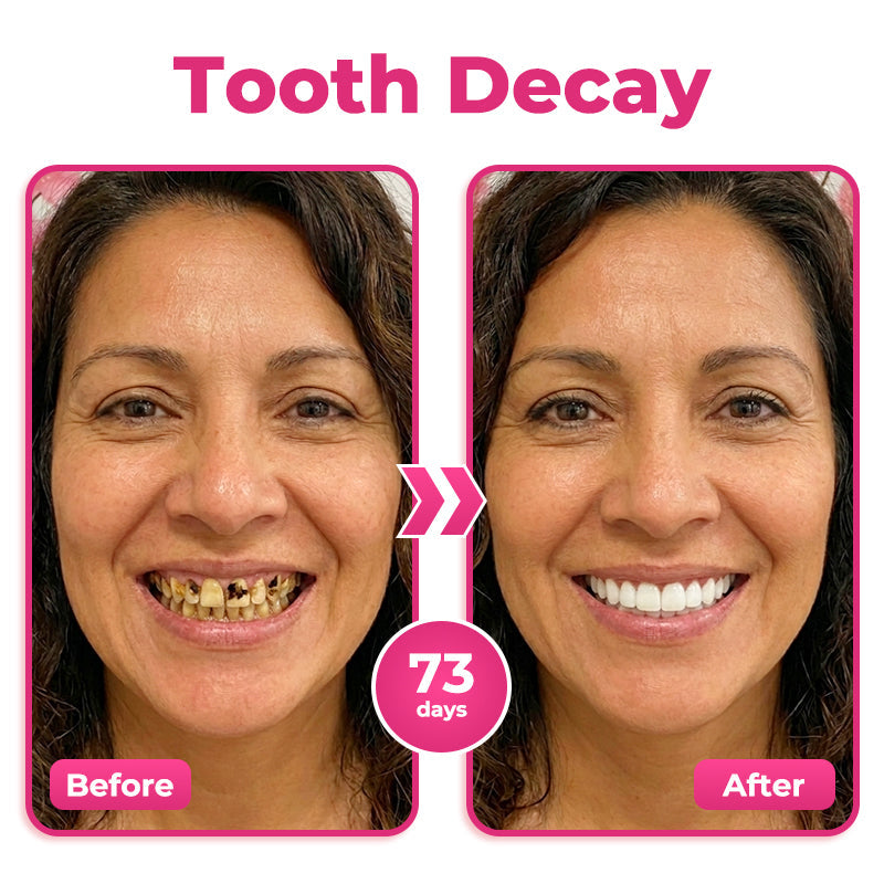 us 🦷  Natravor® Thismile NH-10 Toothpaste Serum for Enamel & Gum Care – Advanced Therapypy