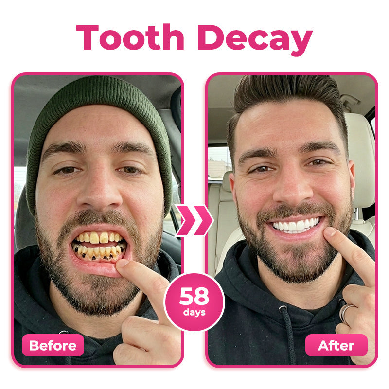 us 🦷  Natravor® Thismile NH-10 Toothpaste Serum for Enamel & Gum Care – Advanced Therapypy