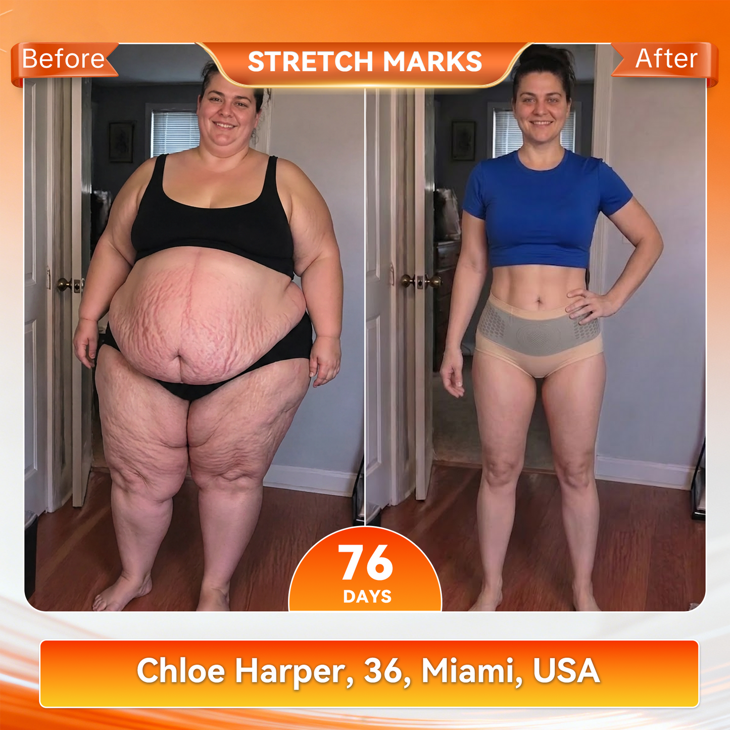 𝐎𝐟𝐟𝐢𝐜𝐢𝐚𝐥 𝐁𝐫𝐚𝐧𝐝 𝐒𝐭𝐨𝐫𝐞 👙 Natravor® 𝟐𝟎𝟐𝟔 𝐌𝐨𝐫𝐢𝐧𝐠𝐚 & 𝐁𝐞𝐫𝐛𝐞𝐫𝐢𝐧𝐞 𝟒-𝐈𝐧-𝟏 𝐌𝐢𝐜𝐫𝐨-𝐏𝐚𝐫𝐭𝐢𝐜𝐥𝐞 𝐒𝐜𝐮𝐥𝐩𝐭𝐢𝐧𝐠 & 𝐅𝐚𝐭-𝐁𝐮𝐫𝐧 𝐒𝐡𝐨𝐫𝐭𝐬