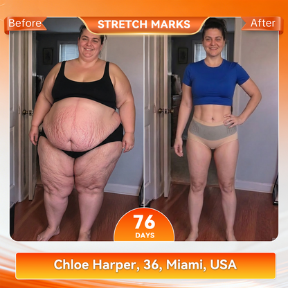 𝐎𝐟𝐟𝐢𝐜𝐢𝐚𝐥 𝐁𝐫𝐚𝐧𝐝 𝐒𝐭𝐨𝐫𝐞 👙 Natravor® 𝟐𝟎𝟐𝟔 𝐌𝐨𝐫𝐢𝐧𝐠𝐚 & 𝐁𝐞𝐫𝐛𝐞𝐫𝐢𝐧𝐞 𝟒-𝐈𝐧-𝟏 𝐌𝐢𝐜𝐫𝐨-𝐏𝐚𝐫𝐭𝐢𝐜𝐥𝐞 𝐒𝐜𝐮𝐥𝐩𝐭𝐢𝐧𝐠 & 𝐅𝐚𝐭-𝐁𝐮𝐫𝐧 𝐒𝐡𝐨𝐫𝐭𝐬