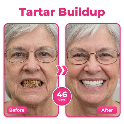 us 🦷  Natravor® Thismile NH-10 Toothpaste Serum for Enamel & Gum Care – Advanced Therapypy